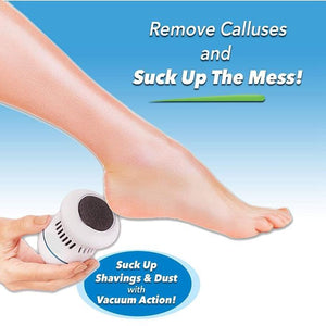 Electric Callus Remover - Built-In Vacuum Rechargeable Motorized Feet Foot Pedicure Tool Exfoliation Dead Skin